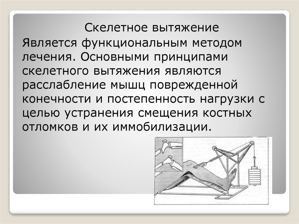 Скелетное вытяжение презентация