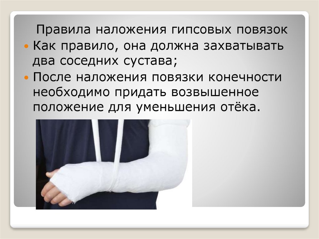 Наложение гипса. Наложение гипсовой повязки. Правило наложение повязок. Правила наложения гипсовых повязок. Гипсовые повязки. Наложение гипсовой повязки..