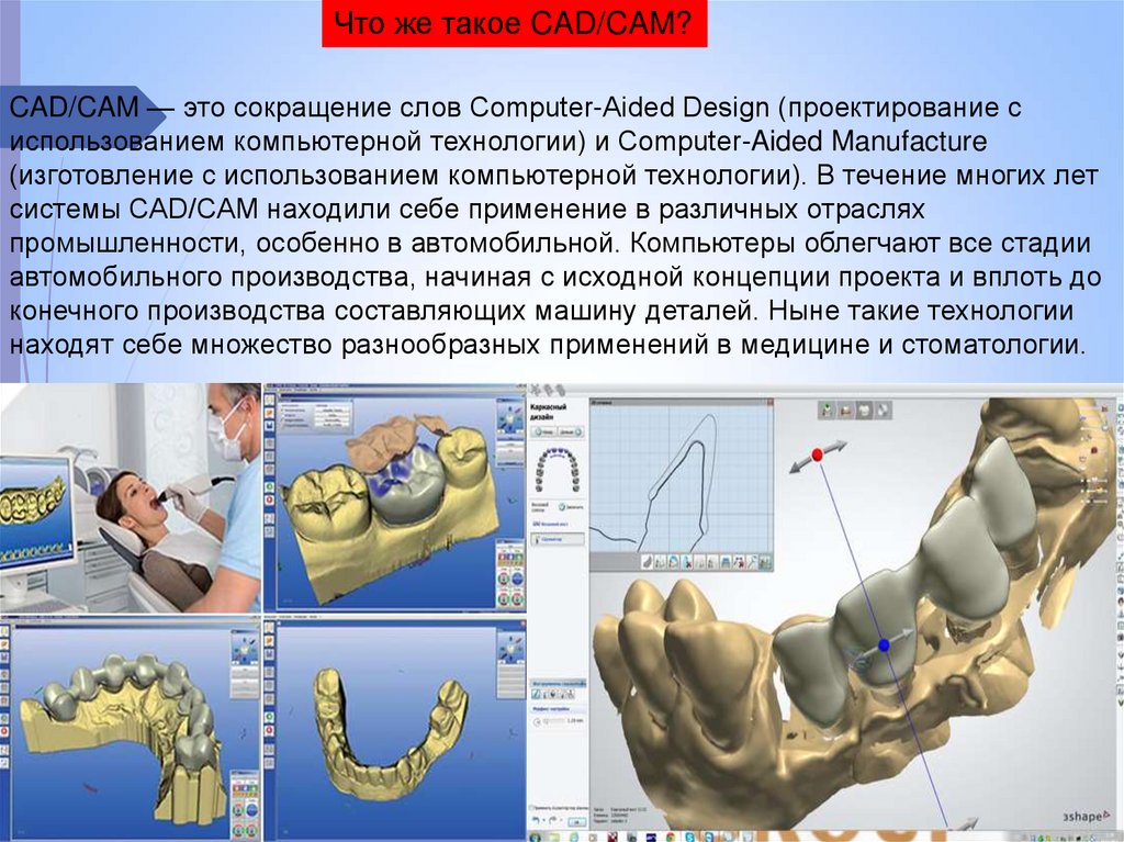 Сам системы. CAD cam системы в стоматологии. КАД Кам системы в стоматологии ортопедия. CAD cam технологии в ортопедической стоматологии. Технологии CAD/cam в стоматологии презентация.