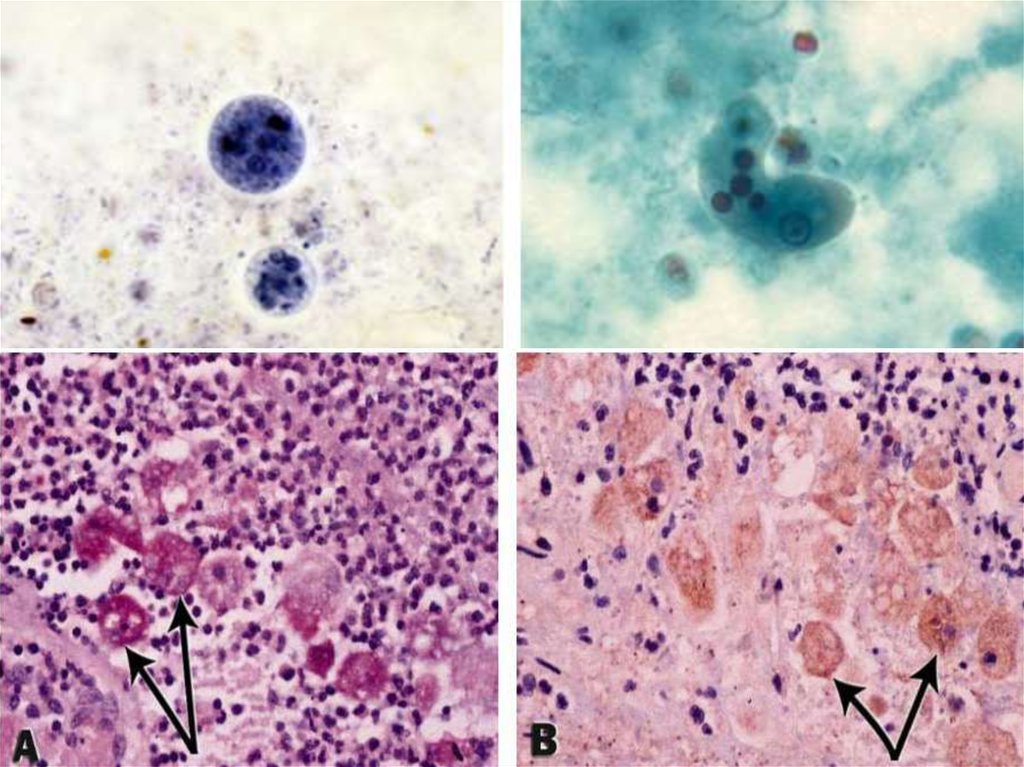 Хламидиоз микоплазма. Гистомоноз трихомоноз. Трихомониаз микроскопия. Гистомоноз микроскопия.