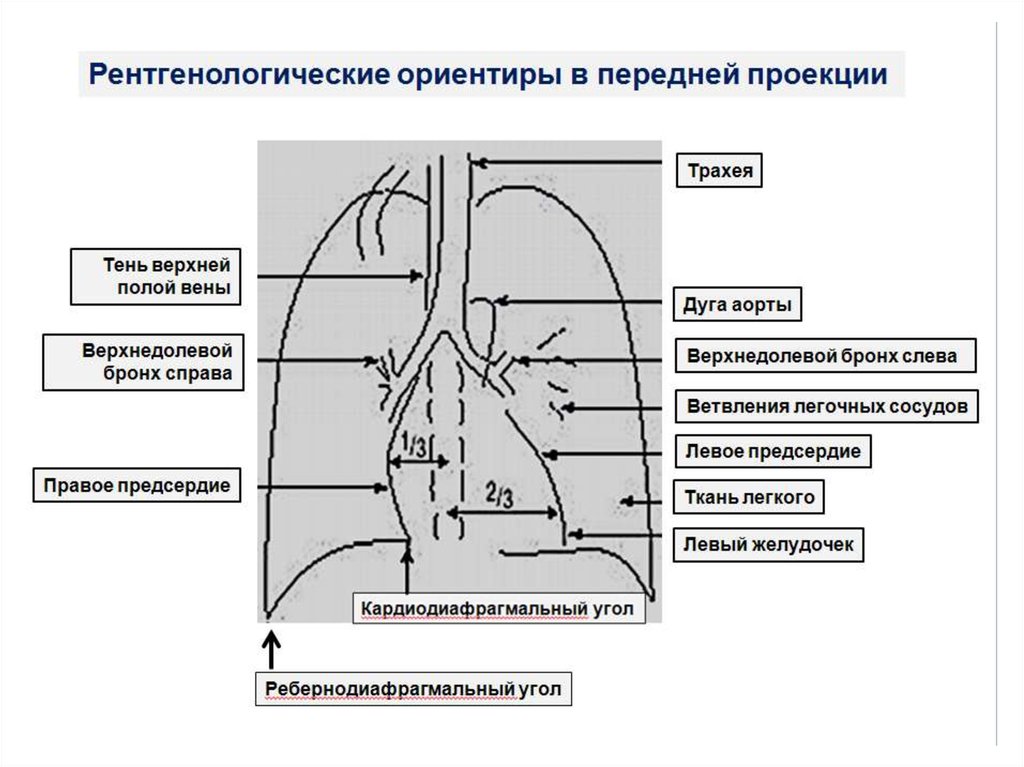 Кардиодиафрагмальный синус. Кардиодиафрагмальный угол справа. Физиология легких. Кардиодиафрагмальный синус на рентгенограмме справа.