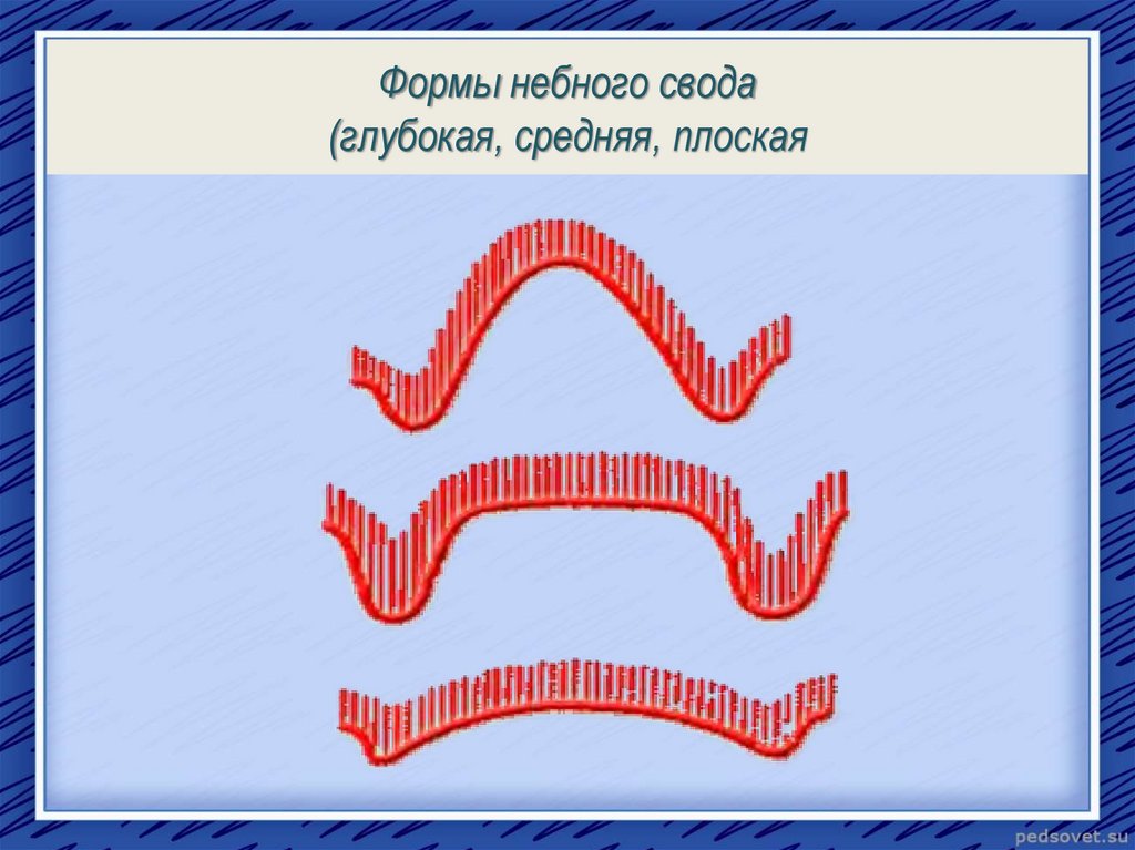 Выше глубже. Форма свода твердого неба.