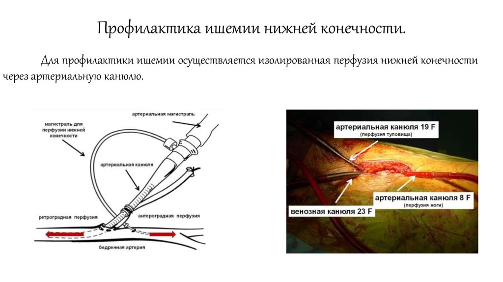 Оперативная хирургия нижней конечности презентация