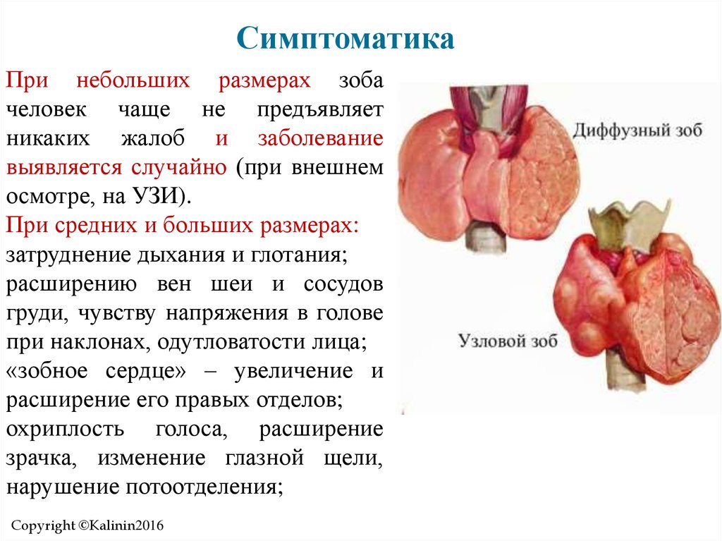 Заболевания щитовидной железы презентация