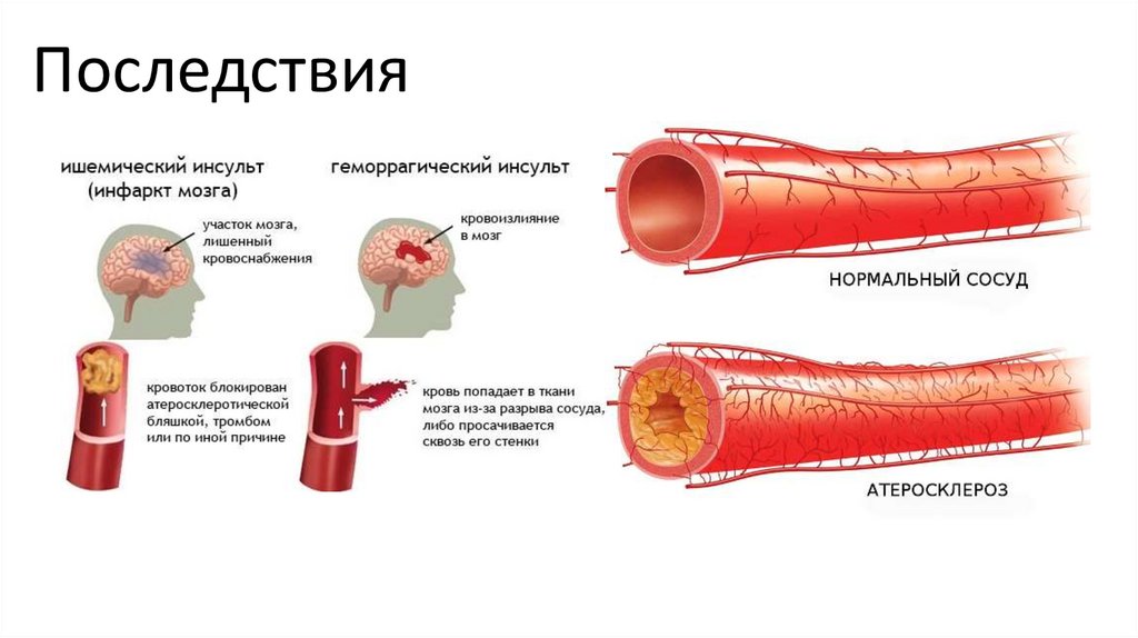 Последствия