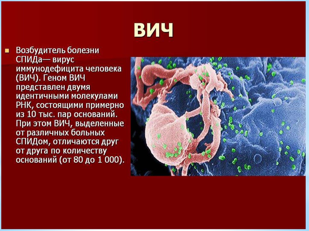 Спид болезнь презентация