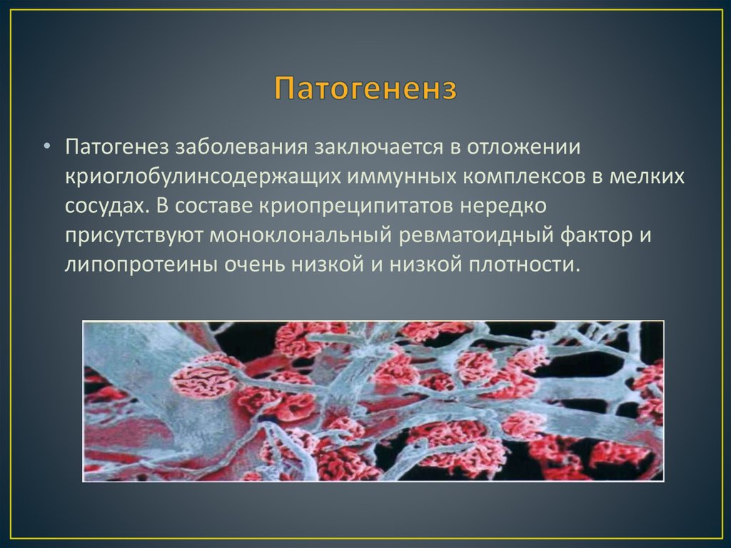 Патогененз