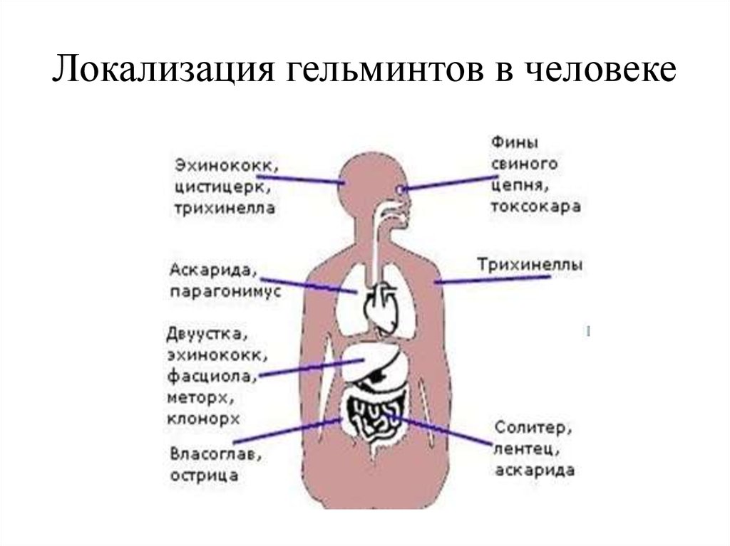 По строению и форме гельминты бывают схема