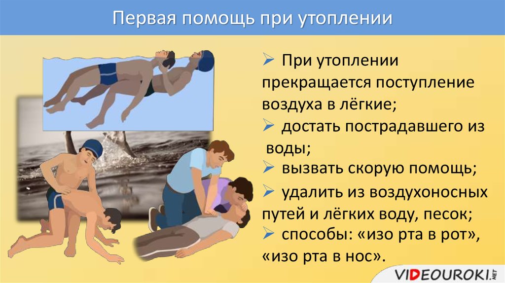 Утопление презентация медицина