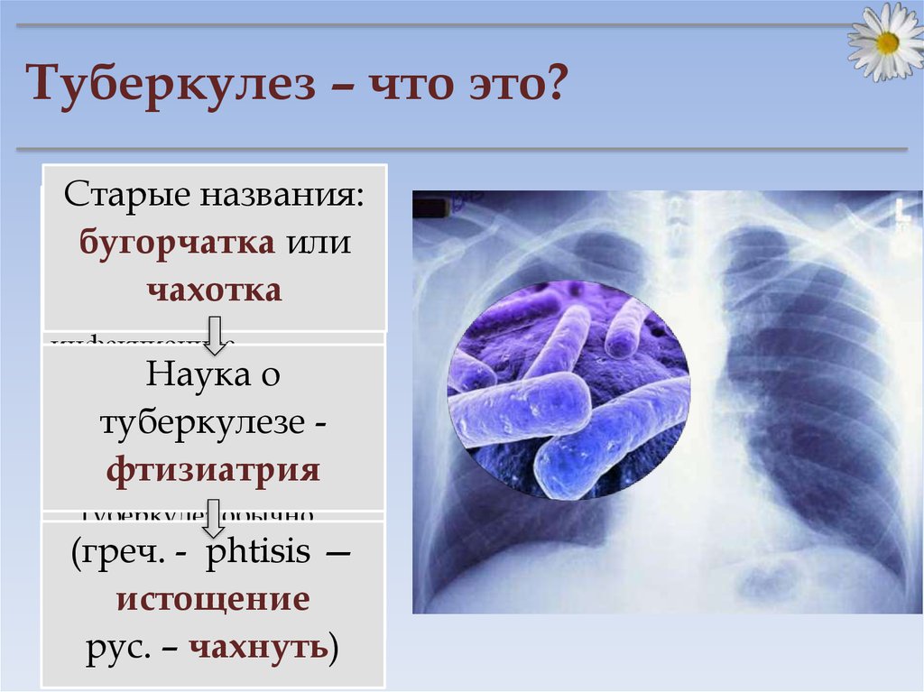 Презентация по туберкулезу