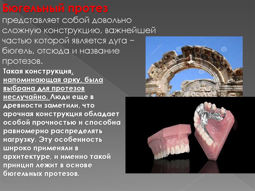 Бюгельные протезы презентация