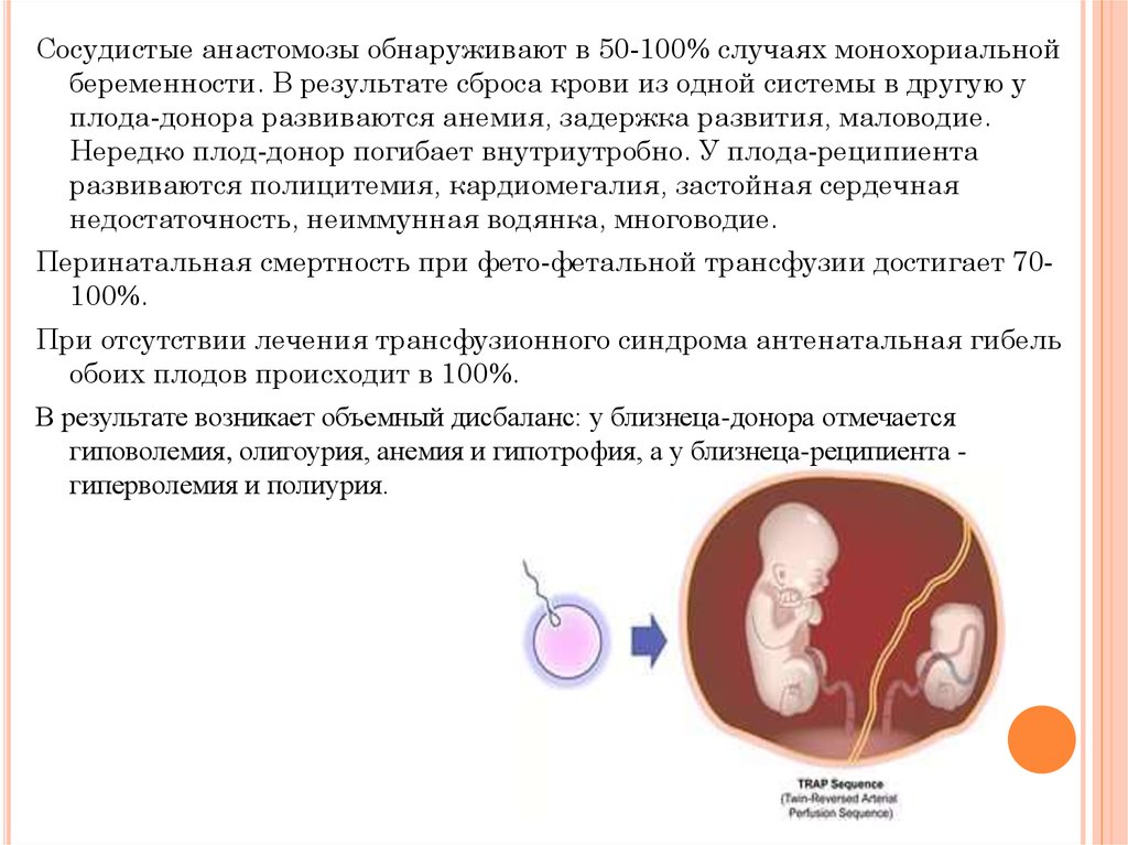 Фето фетальный трансфузионный синдром