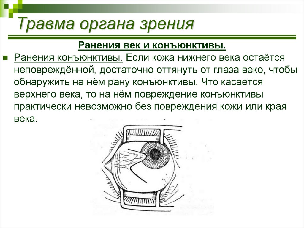 Органы несчастного случая. Неотложная помощь при травме органа зрения. Характер повреждения органа зрения.