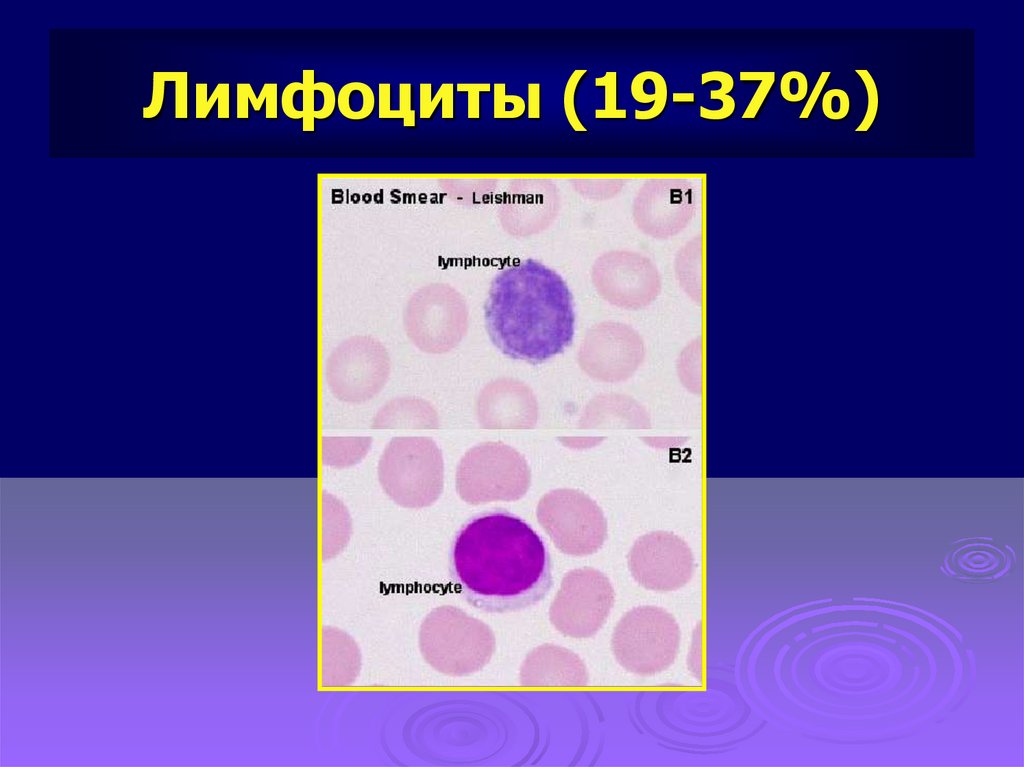Лимфоциты структура. Лимфоциты гистология строение. Лимфоциты гистология препарат. Лимфоциты мазок крови. Лимфоцит рисунок.