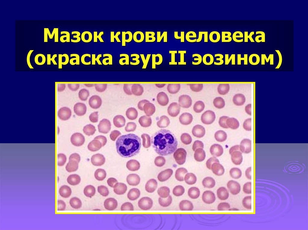 Методы окраски мазков. Окраска Азур 2 эозином. Клетки крови окраска Азуром 2-эозином. Мазок крови окраска Азур 2 эозином. Мазок крови человека по Романовскому-Гимзе Азур 2- эозин.