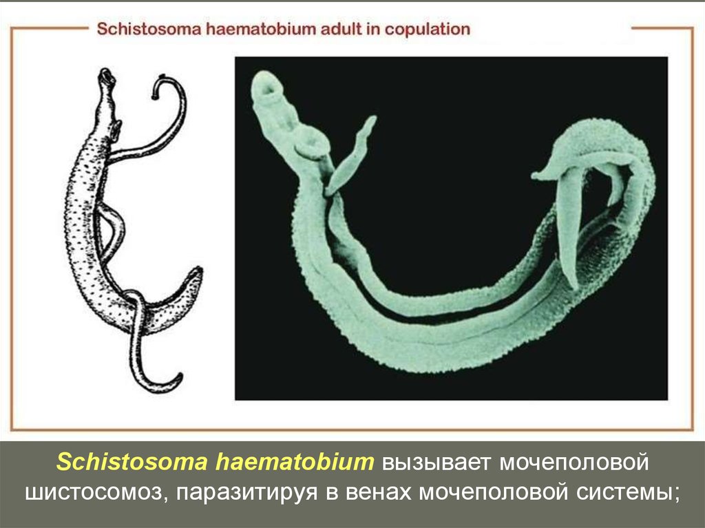 Шистосома. Шистосома haematobium. Кровяной сосальщик Schistosoma haematobium. Кровяная двуустка (Schistosoma haematobium). Шистосома Мансони строение.