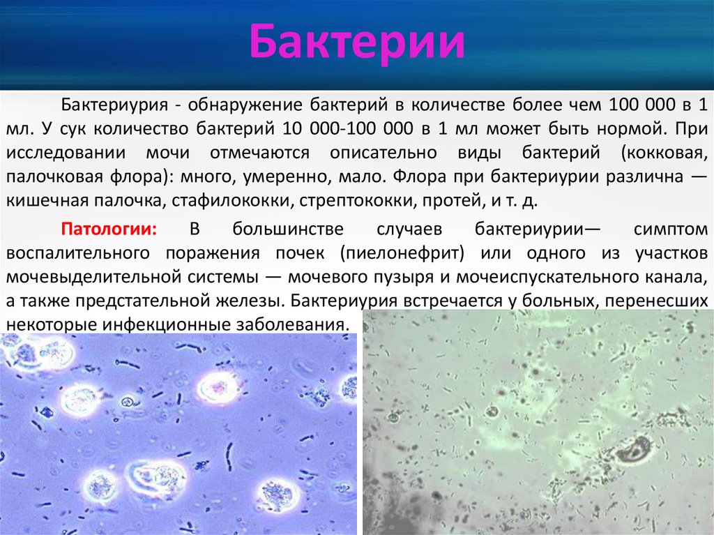 Что означает большое количество бактерий в моче. Бактериурия микроскопия. Бактерии в моче. Микроорганизмы в моче. Бактерии в осадке мочи.