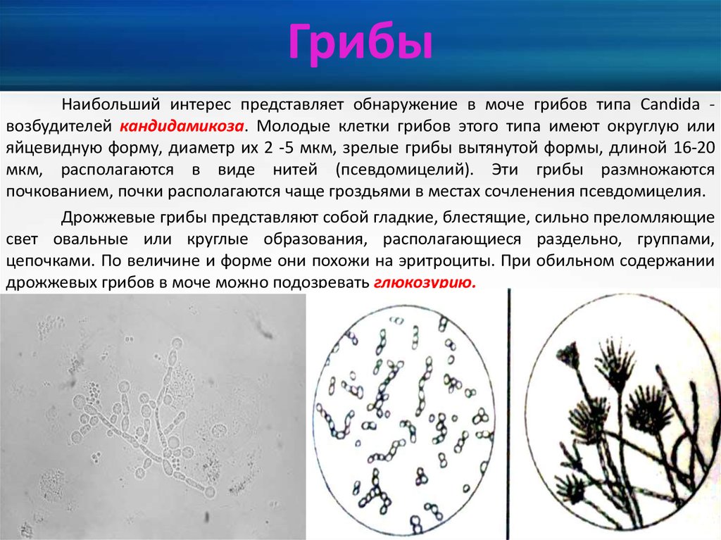 Обнаружены споры и мицелий. Мицелий гриба микроскопия. Грибы кандида микроскопия. Дрожжевые клетки гриба рода кандида. Микроскопические грибы Candida.