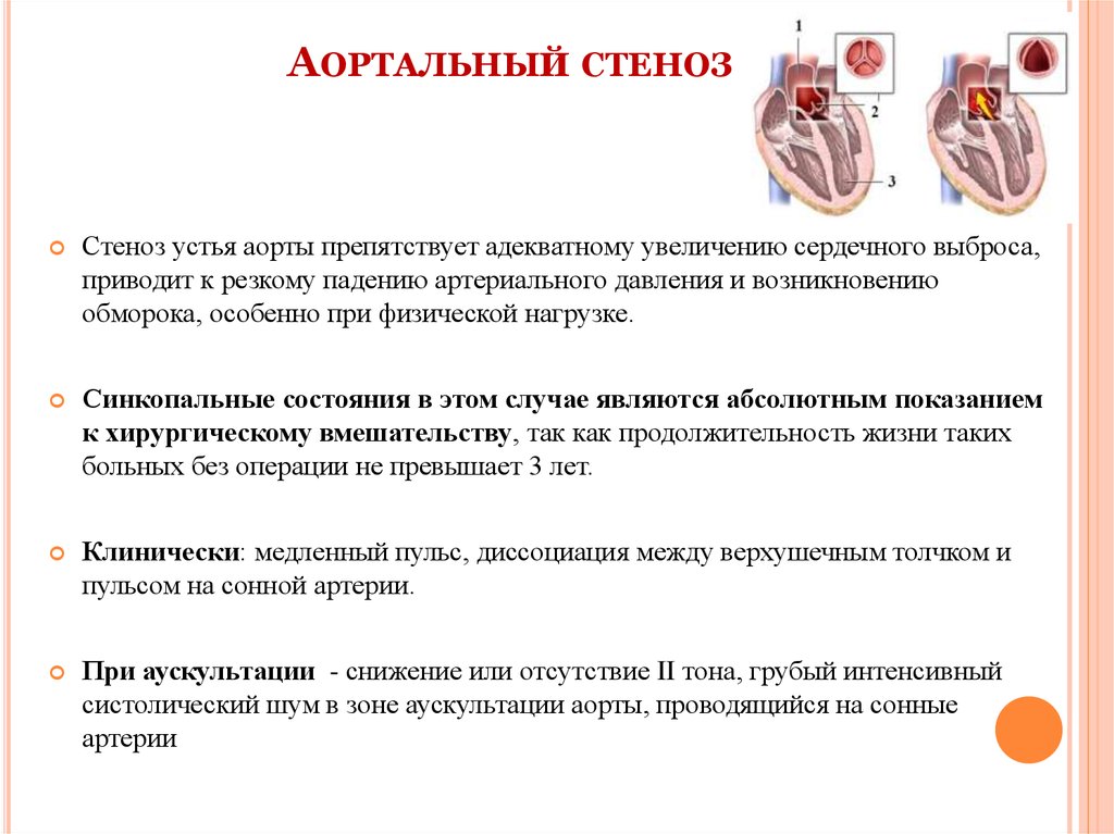 Стеноз это. Стеноз аортального клапана причины. Стеноз аортального клапана клинические проявления. Причиной приобретённого стеноза аортального клапана является. Причина приобретенного стеноза аортального клапана.