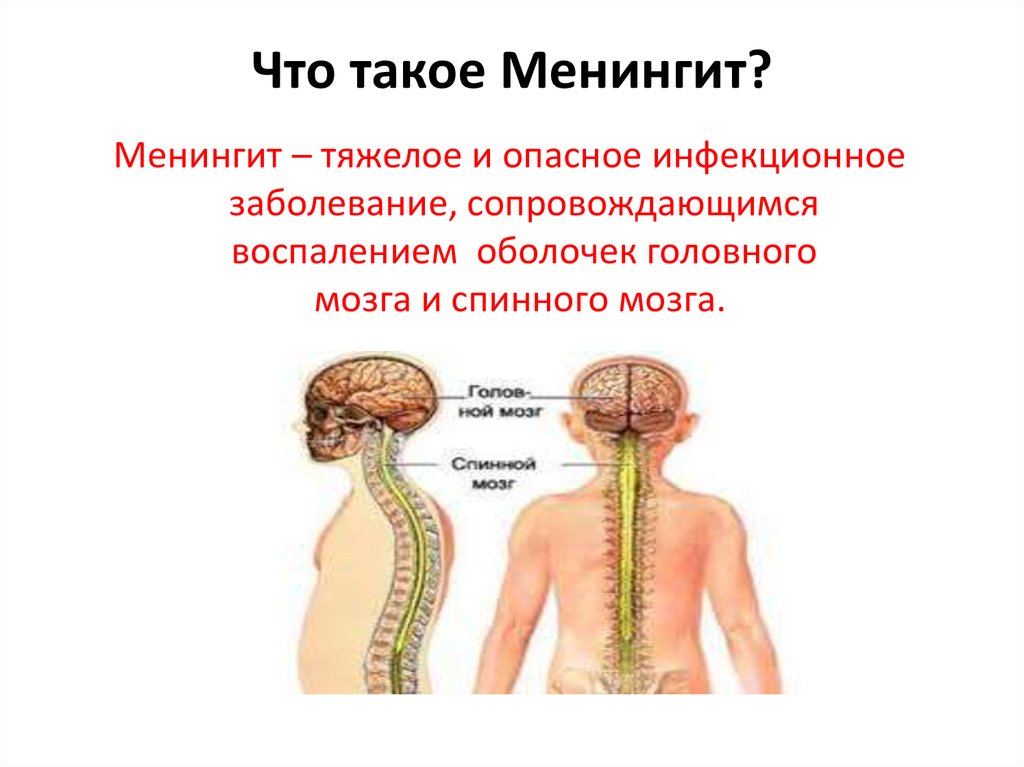 Заболевания головного и спинного мозга. Гнойный менингит спинного мозга. Менингит поражает спинной мозг. Менингит-воспаление оболочек спинного мозга. Спинальный менингит Гнойный менингит.