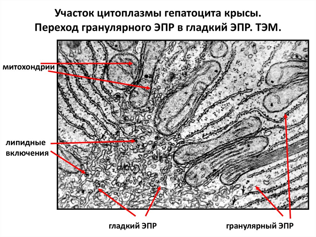 Гранулярный ретикулум