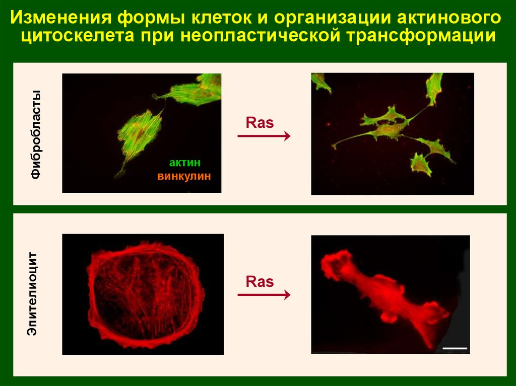 Изменения 6. Изменение формы клетки. Процесс неопластической трансформации. Неопластическая трансформация клеток. Клетки изменяющие форму.