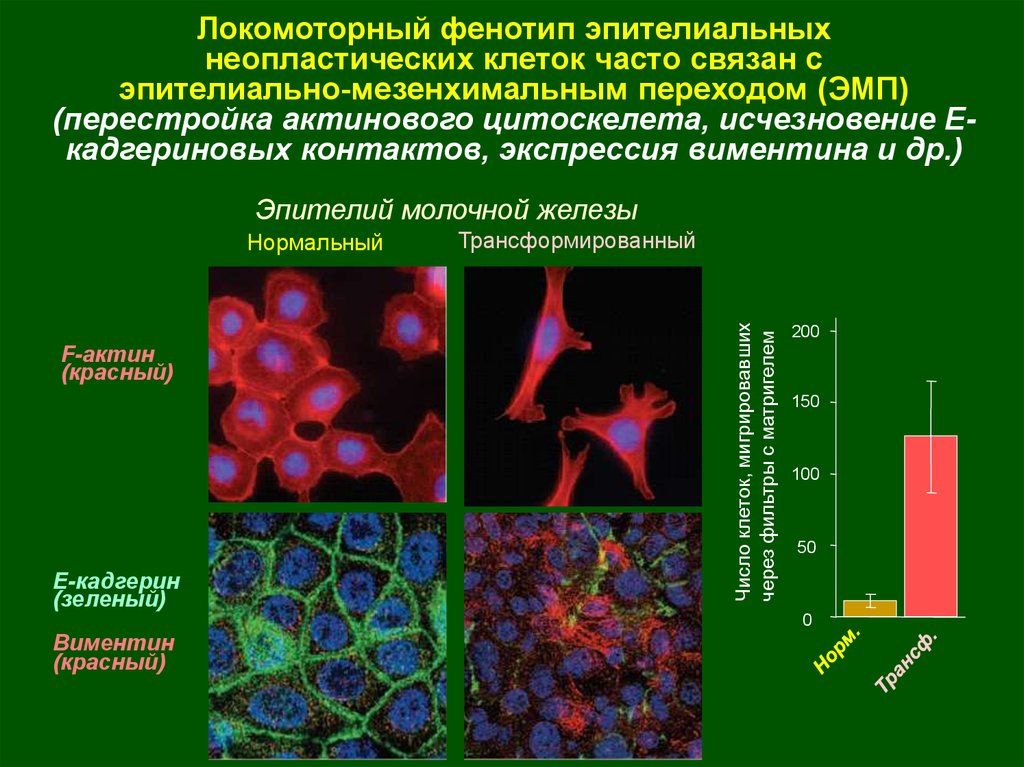 Диффузная экспрессия клеток. Неопластические клетки. Фенотип опухолевых клеток. Экспрессия клеток это.