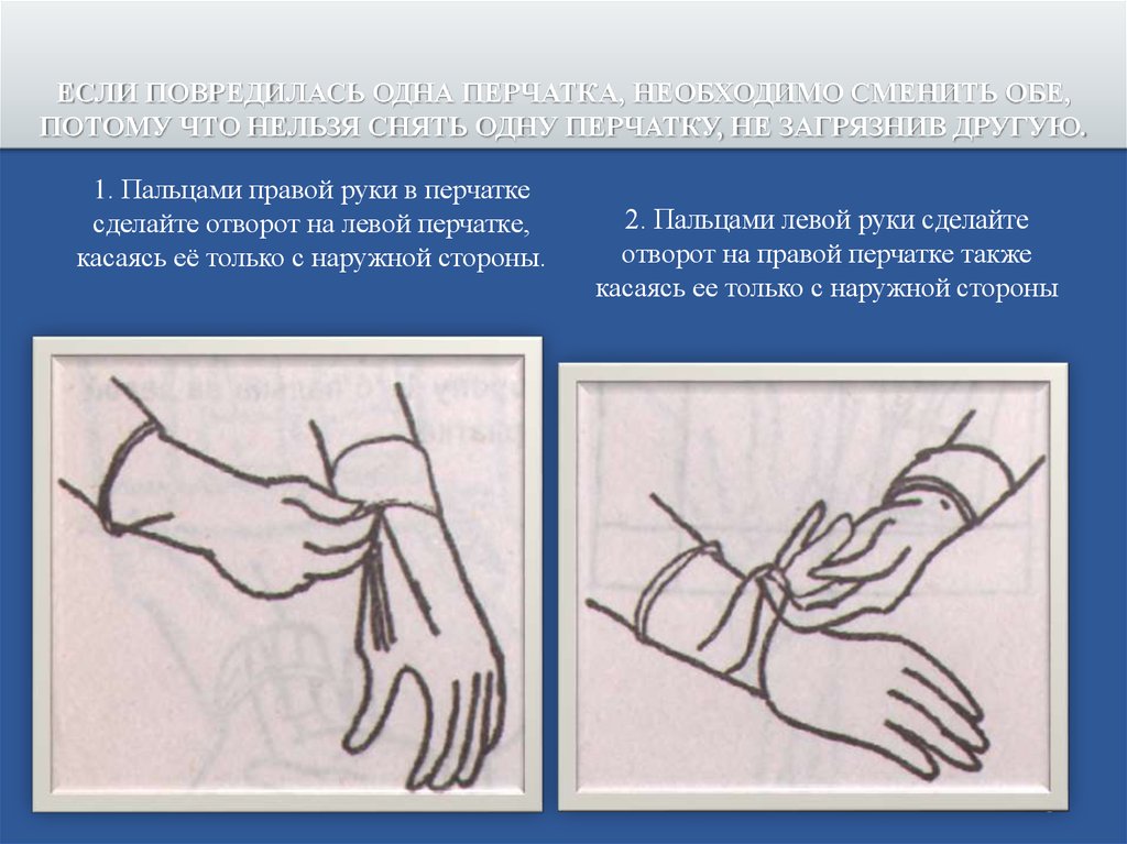 После снятия перчаток. Бесконтактный метод снятия перчаток. Одна перчатка. Перчатку с левой руки. Рисунок техника снятия перчаток.