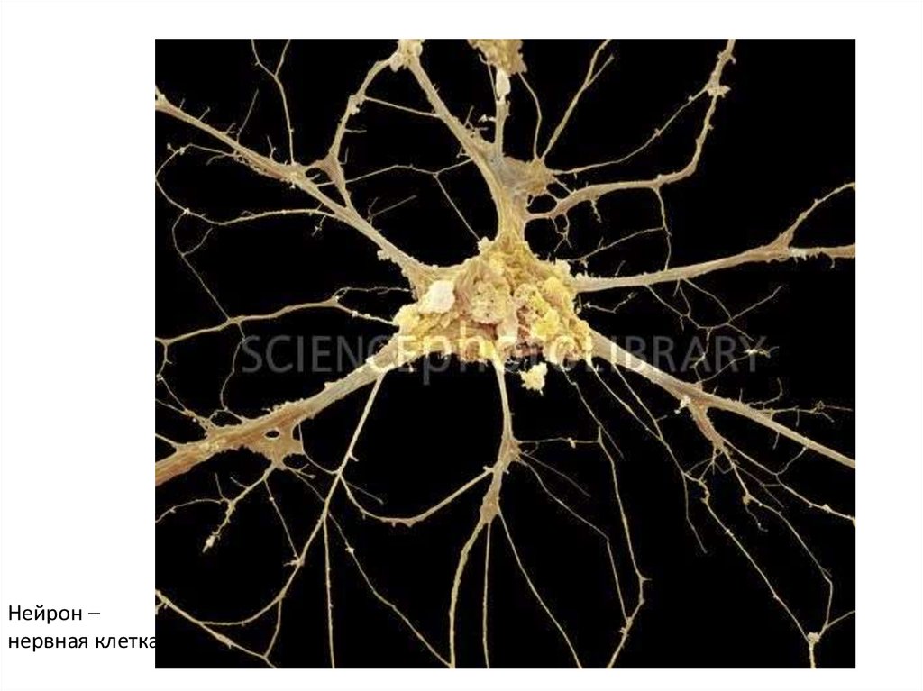 Умершие клетки мозга. Периферическая глия. Аксон нейрона микрофотография. Нерв под микроскопом. Ткань мозга под микроскопом.