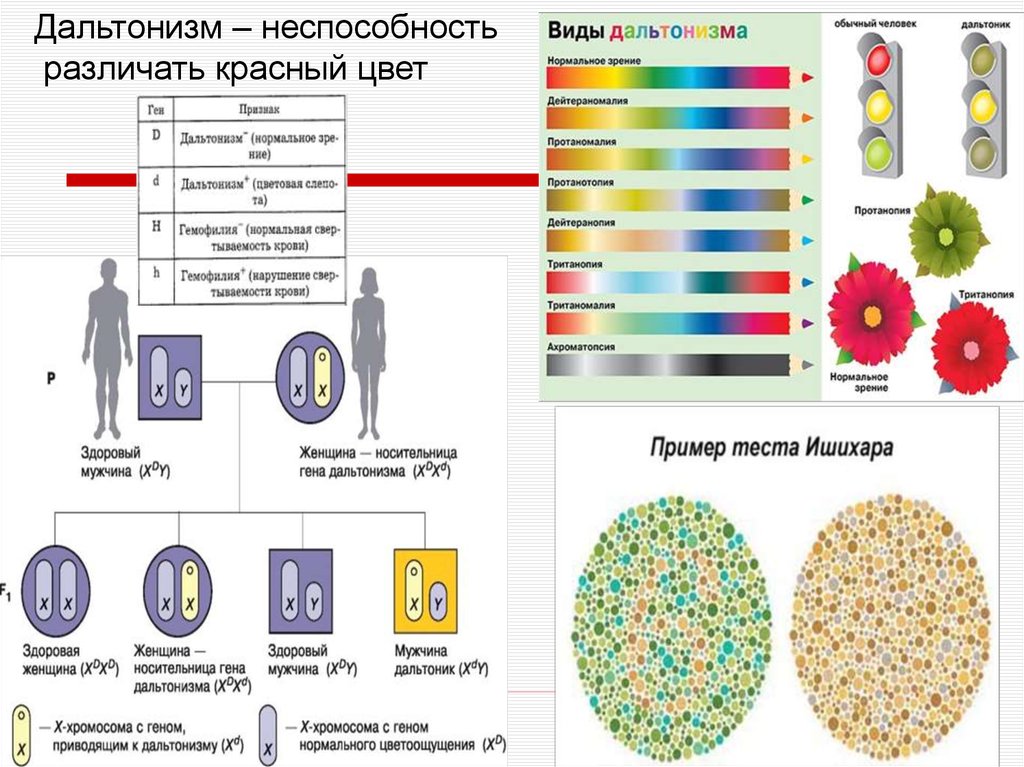 Нарушение цвета. Дальтонизм генные болезни человека. Дальтонизм (цветовая слепота) симптомы. Дальтонизм клинические проявления. Неспособность различать цвета.