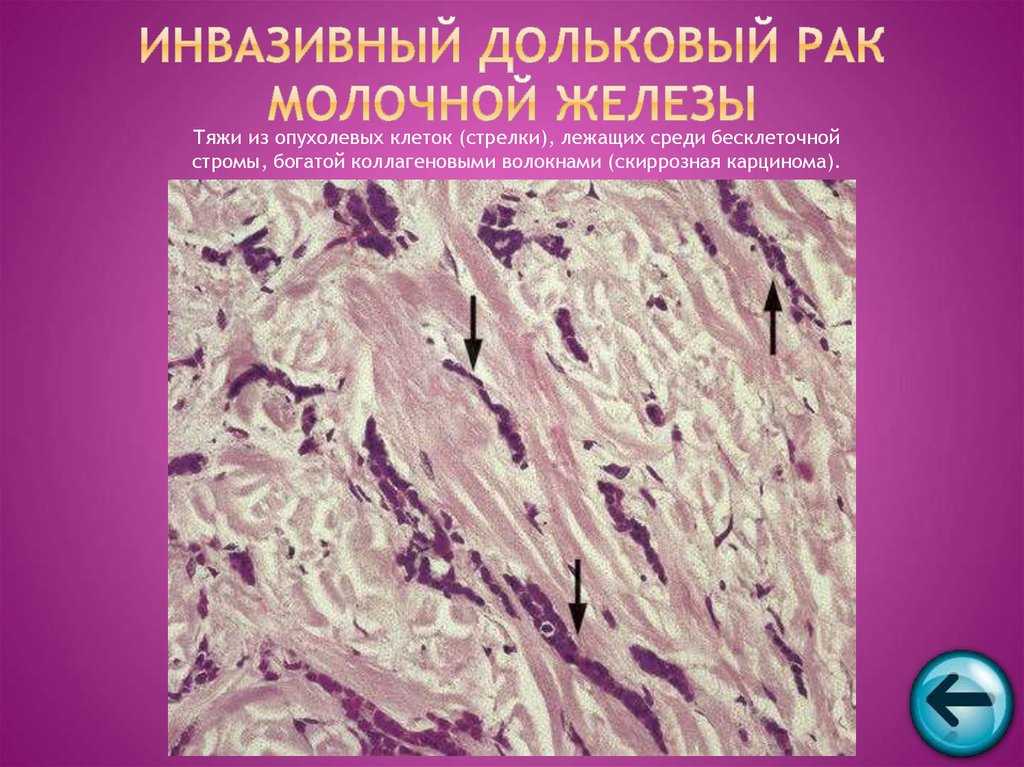 a papillomatosis bőrpatológiája felvázolja)