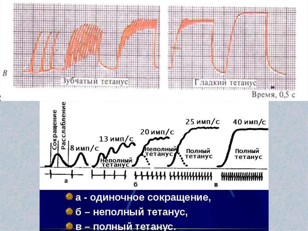 Частота сокращения мышц человека. Одиночное сокращение зубчатый и гладкий тетанус. Одиночное сокращение зубчатый тетанус гладкий тетанус. Зубчатый тетанус одиночное сокращение. Зубчатый тетанус - это мышечное сокращение.