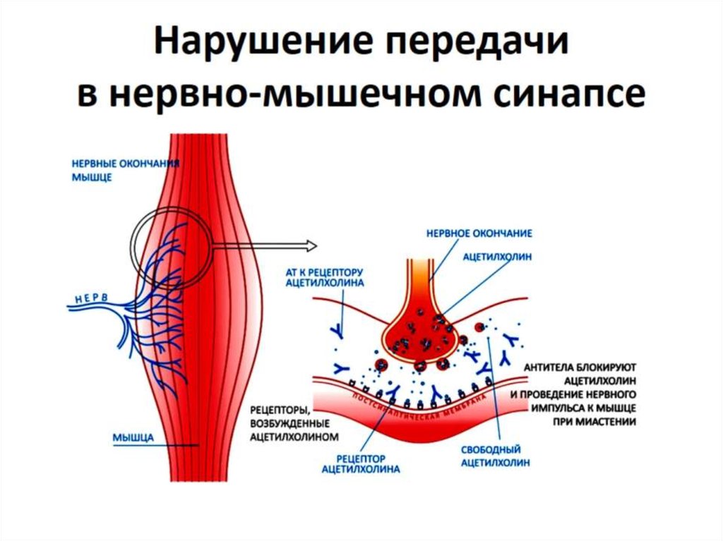 Нарушение передачи в нервно-мышечном синапсе