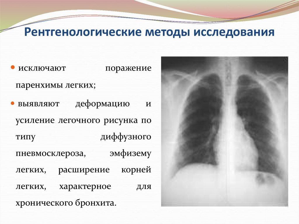 Отделы легочного рисунка. Рентгенологические методы исследования (рентгенодиагностика). Легочный рисунок усилен. Ячеистая деформация легочного рисунка. Легочный рисунок деформирован.