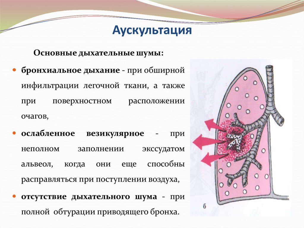 Звуки дыхания при аускультации. Аускультация основные дыхательные шумы. Аускультация легких основные дыхательные шумы. Основные дыхательные шумы при аускультации легких. Аускультация дыхания основные шумы.