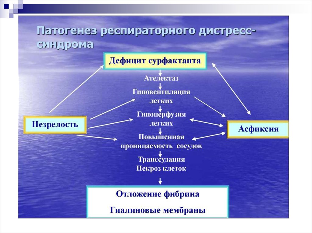 Респираторный дистресс синдром презентация