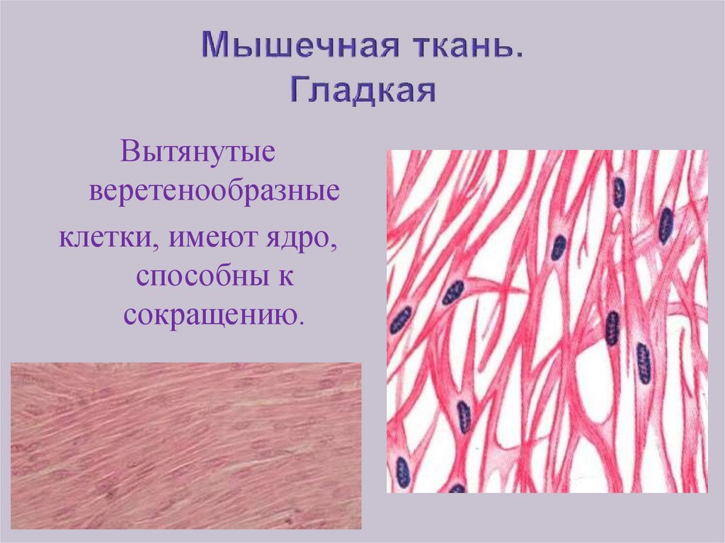 Клетки гладкой мускулатуры сокращаются. Гладкая мышечная ткань веретеновидные клетки. Веретеновидные клетки мышечной ткани. Клетки гладкой мышечной ткани одноядерные. Из чего состоит гладкая мышечная ткань.