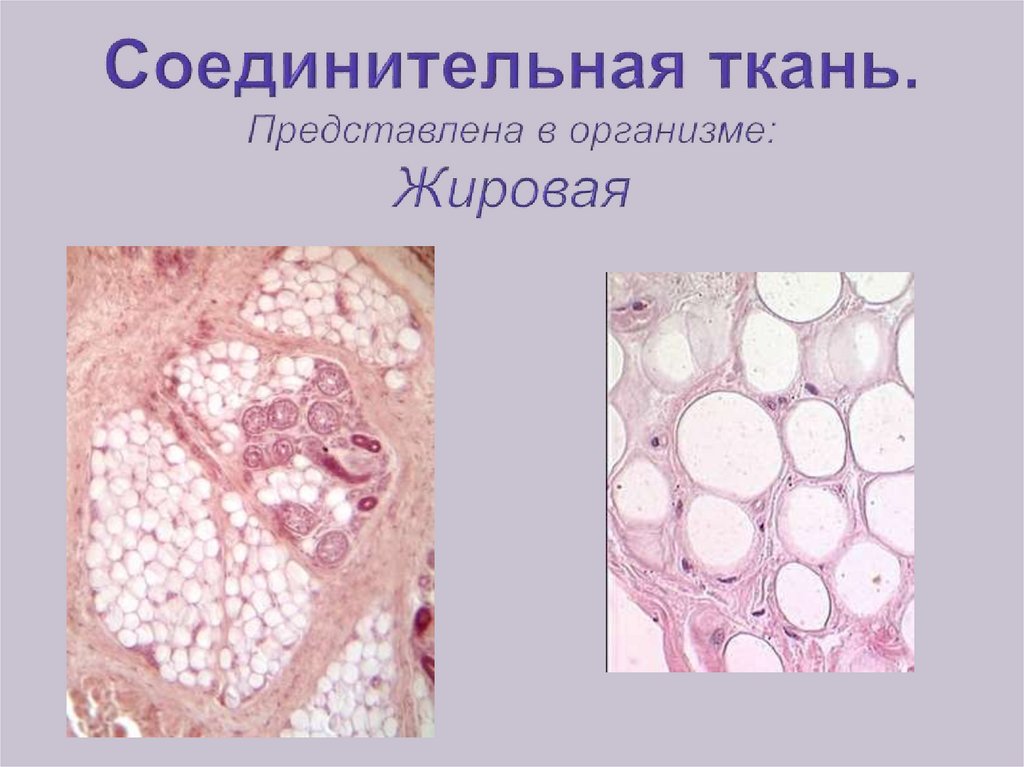 Соединительная жировая ткань рисунок