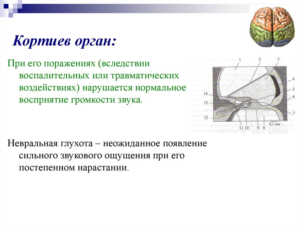 Механизм органа. Сенсорные слуховые расстройства. Кортиев орган воспаление. Невральная глухота возникает при поражении.