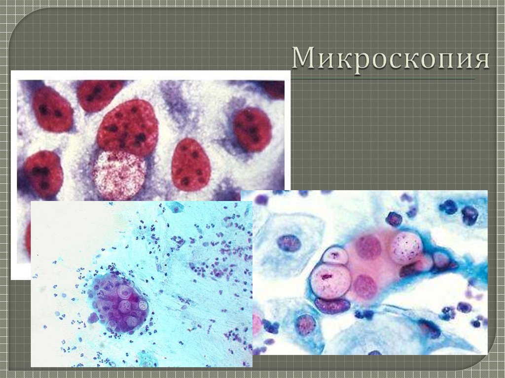 Микроскопия