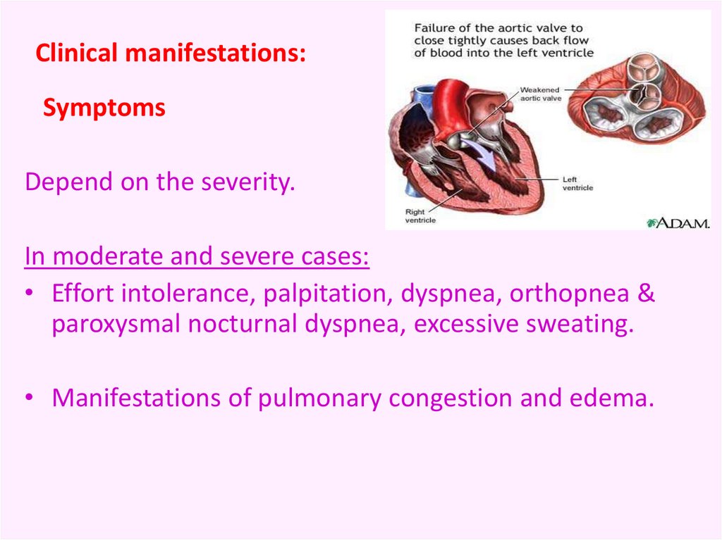 chronic-rheumatic-heart-disease-online-presentation