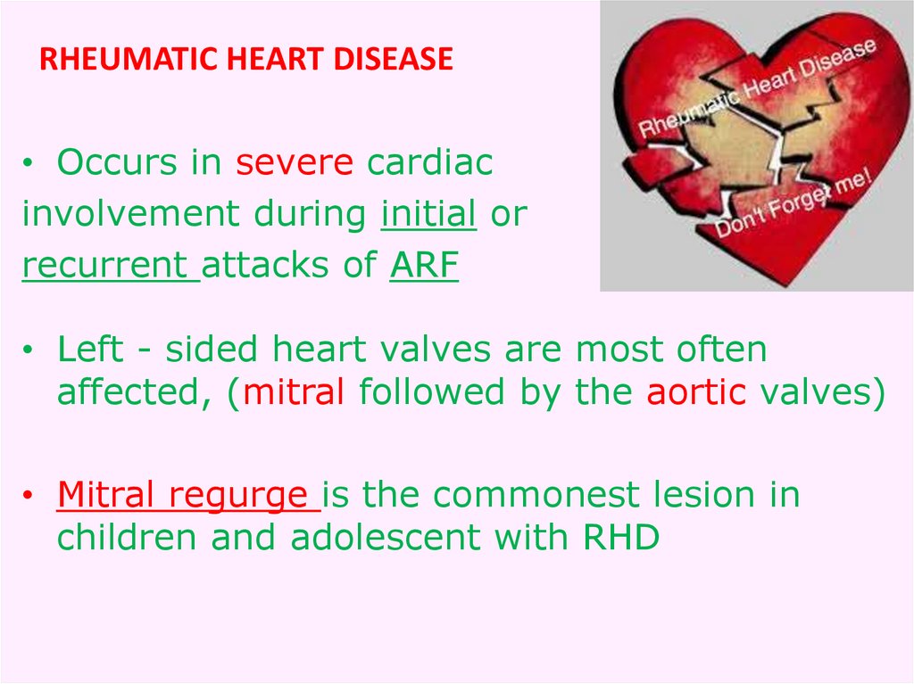 Rheumatic Heart Disease Cause And Cure