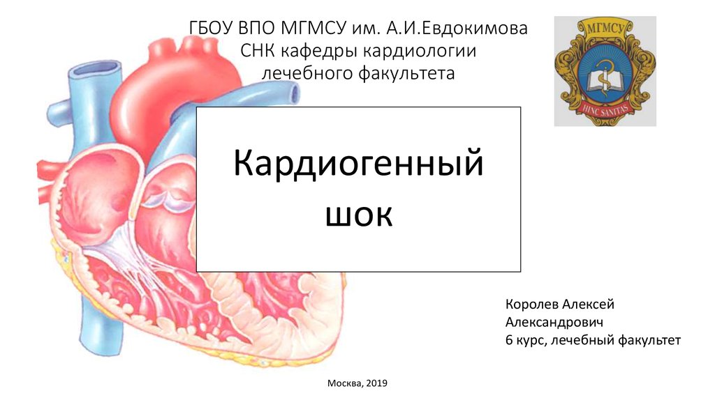 Кардиогенный шок презентация