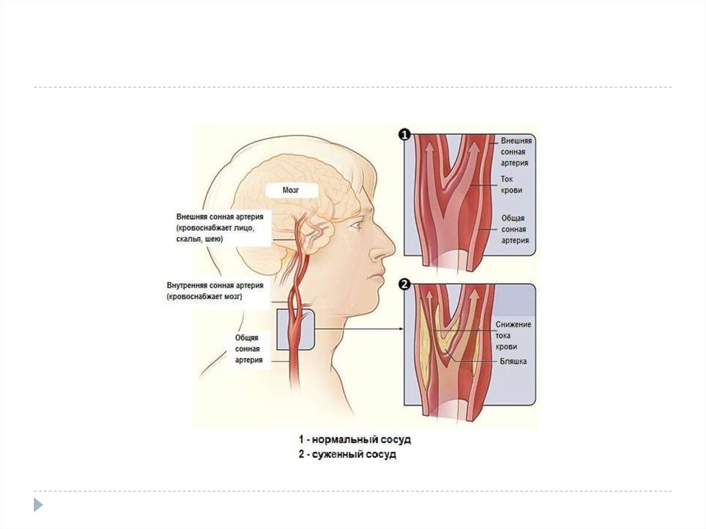Где находится сонная артерия слева. Левая Сонная артерия кровоснабжает. Гдетнаходится согная артерия. Где находится Сонная артерия у человека.