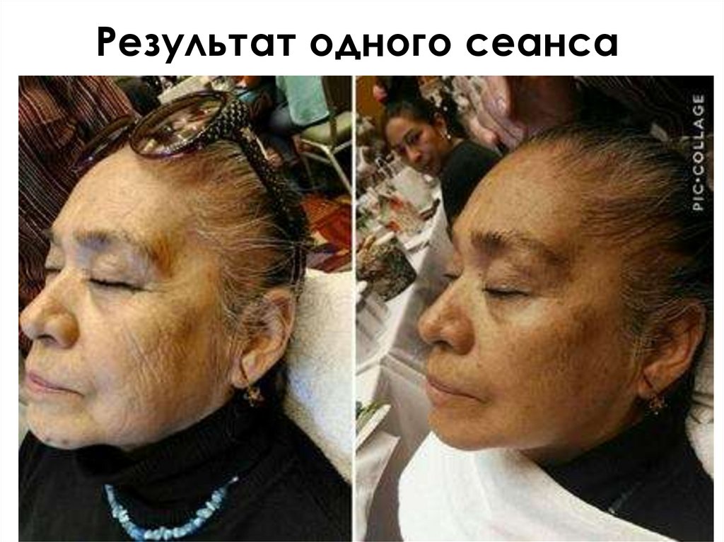 Результат одного сеанса