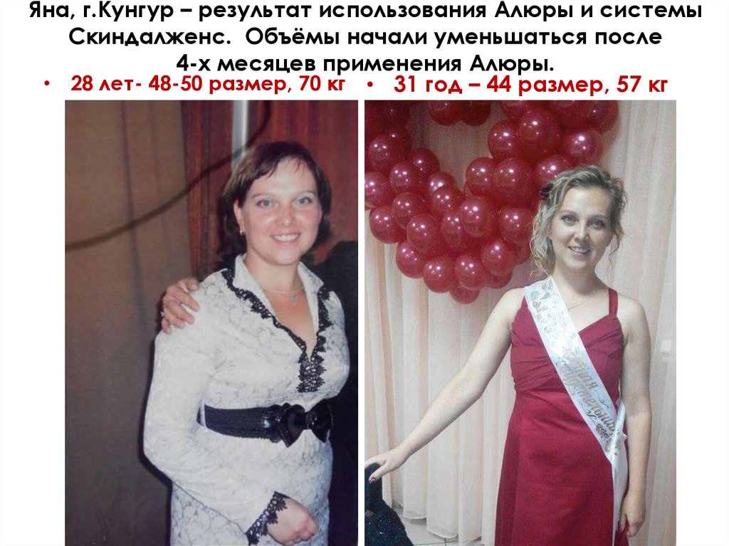 Яна, г.Кунгур – результат использования Алюры и системы Скиндалженс. Объёмы начали уменьшаться после 4-х месяцев применения