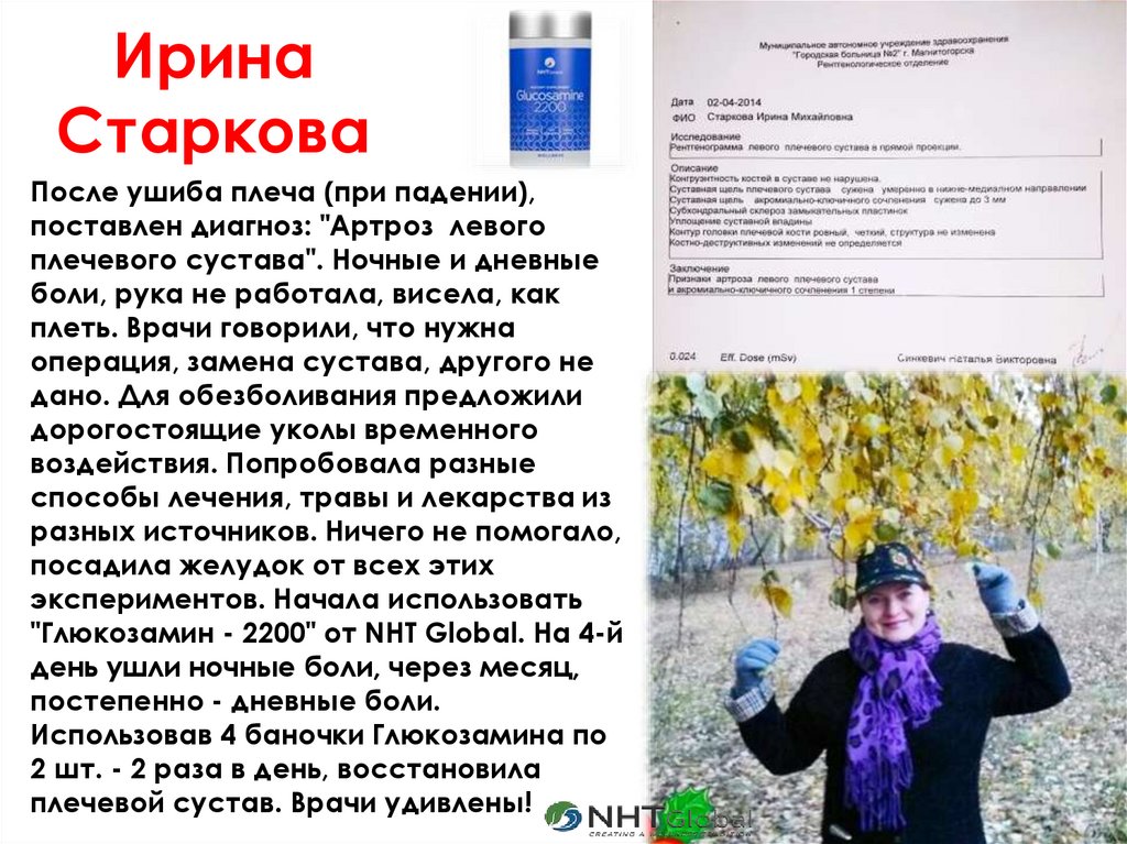 После ушиба плеча (при падении), поставлен диагноз: "Артроз левого плечевого сустава". Ночные и дневные боли, рука не работала,