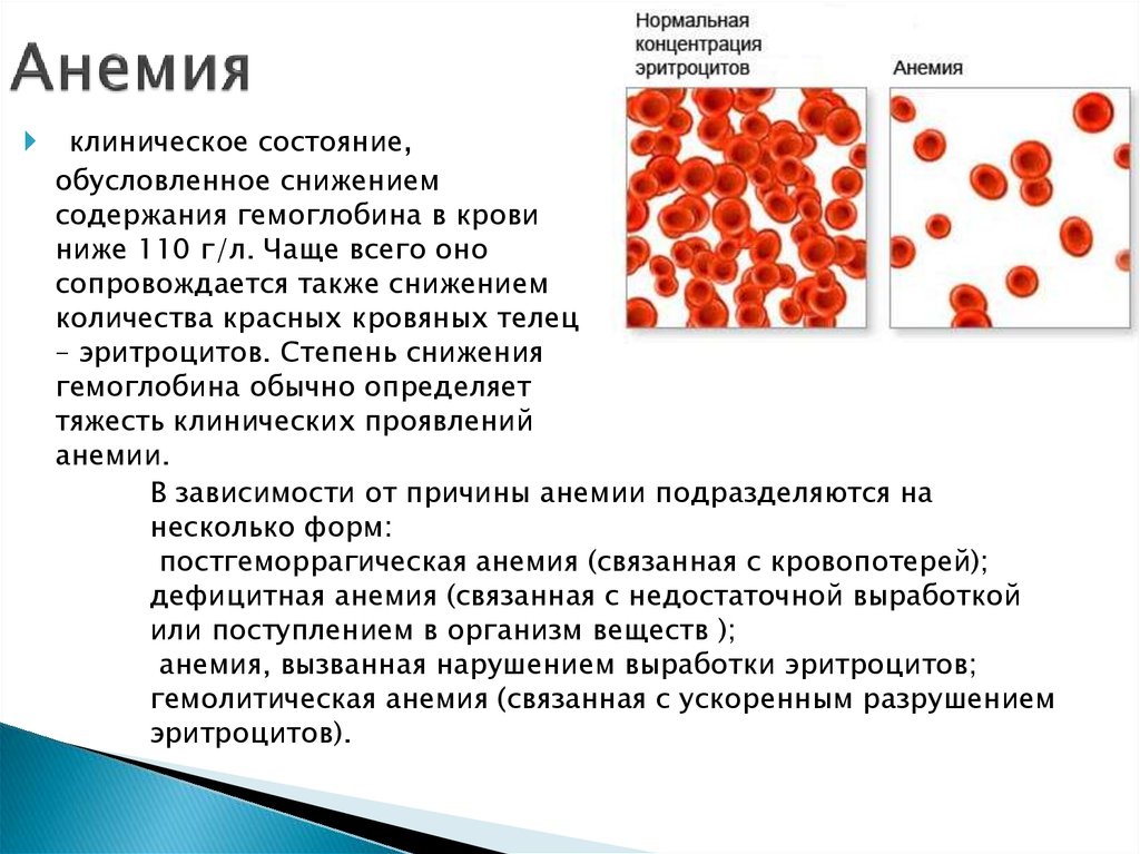 Элементы крови содержащие гемоглобин. Снижение содержания гемоглобина и эритроцитов в крови. Причины понижения уровня гемоглобина в эритроцитах. Анемия 80 гемоглобин. Анемия эритроциты.
