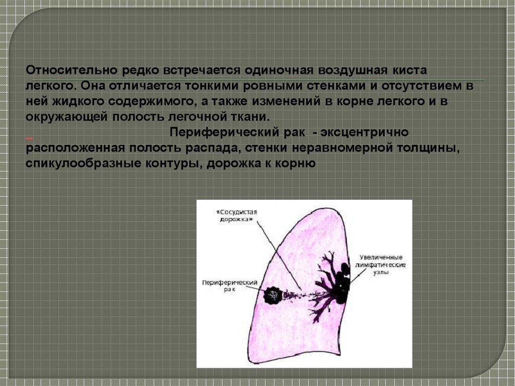 Окруженное легкой. Воздушные кисты в легких. Контуры воздушной легочной кисты. Воздушная киста лёгкого.