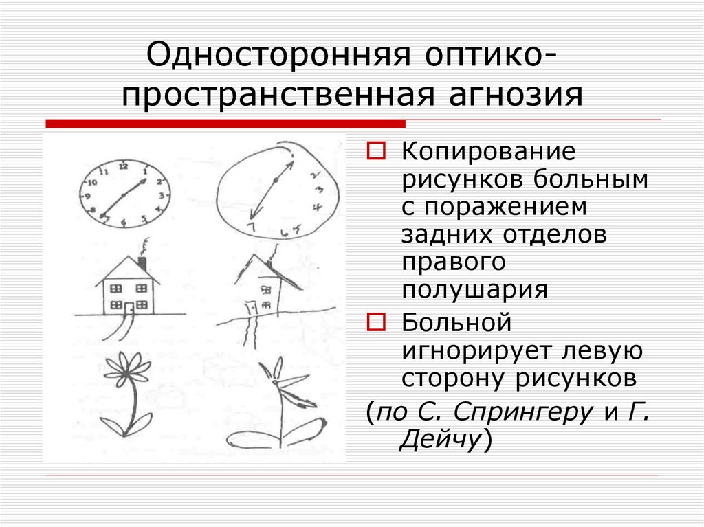 Плохая ориентация больного в пространственных признаках изображения говорит о